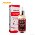 LANBENA Nail Repair Liquid Treatment with File Nail Anti Remove Nail Onychomycosis Fungus Toe Nourishing Brighten Nail TSLM1