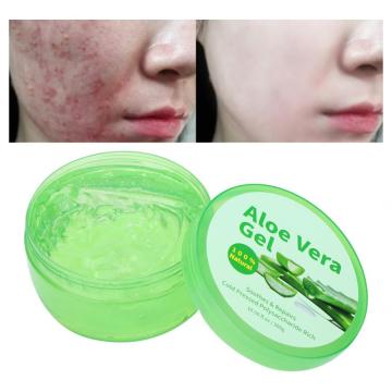 300g Aloe Vera Gel Remove Pimples Shrink Pores After-Sun Repair Moisturizing Face Gel Skin Care for Face Repair Aloe Vera Gel