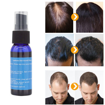Lanthome Hair Growth Oil Products Hair Loss Treatment Regrowth Essence Men and Women Hair Care Growth Serum Beauty Essence
