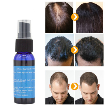 Minoxidil fast hair regrowth serum hair spray essence anti hair fall treatment beard care yuda pilatory women & men