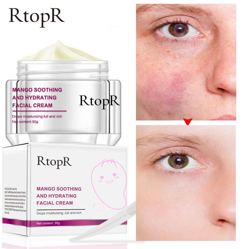 RtopR Mango Moisturizing Facial Cream Anti-Wrinkle Anti Aging Whitening Liquid Tights Nourishing Shrink Pores Hyaluronic Acid