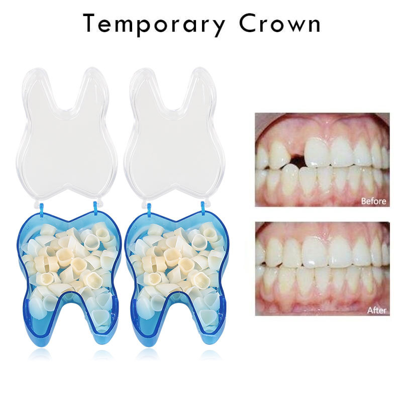 50pcs Dental Temporary Crown 25pcs Teeth Anterior 25pcs Posterior Dentist Materials Dentistry Dental Accessories Tooth whitening
