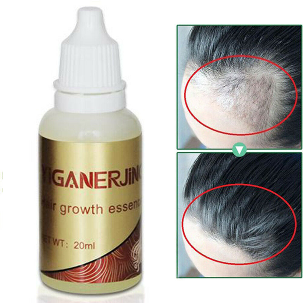 Hair care Hair Growth Liquid Treatment Preventing Hair Loss Natural Protect Dense Hair Serum Drop Shipping TSLM1