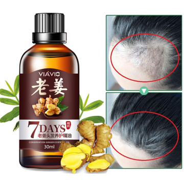 30ml Hair Loss Treatment Fast Hair Growth Dense Regrowth Ginger Serum Oil Effective Repair Damaged Hair Nourish Hair TSLM2