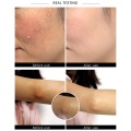 Deep Cleansing Face Moisturizing Cleanser Oil Control Reducing Pores Remove Blackhead Face Cleanser Oxygen Foam Mousse