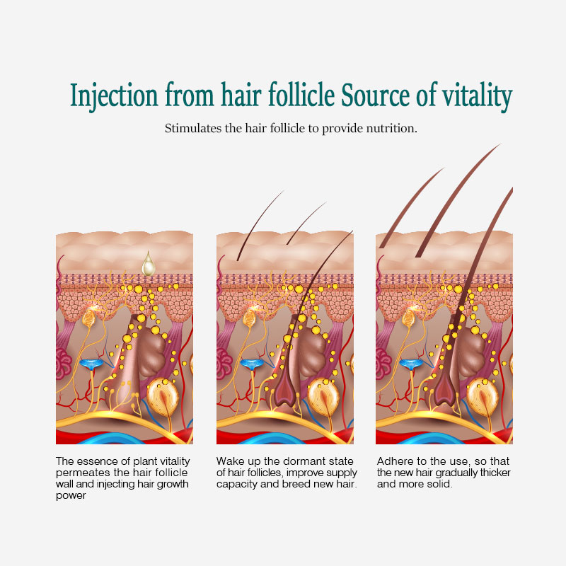 ARTISCARE Hair Growth Essential Oil Hair Care Treatment For Men And Women Hair Loss Essence Liquid Repair Hair Root 20ml 5PCS