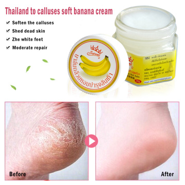 20g Banana Oil Foot Cream Repair Moisturizing Whitening Foot Care Exfoliating Anti-dry ageless skin care Foot Crack Cream TSLM1