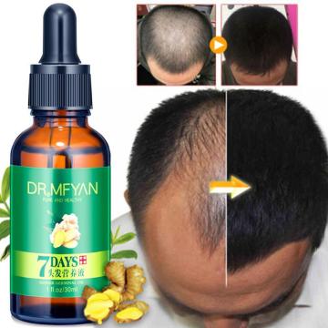 30ml Natural Hair Loss Treatement Effective Hair Growth Serum Oil Serum Fiber Hair Germinal Oil Nutrition Days 7 Ginger W7N1