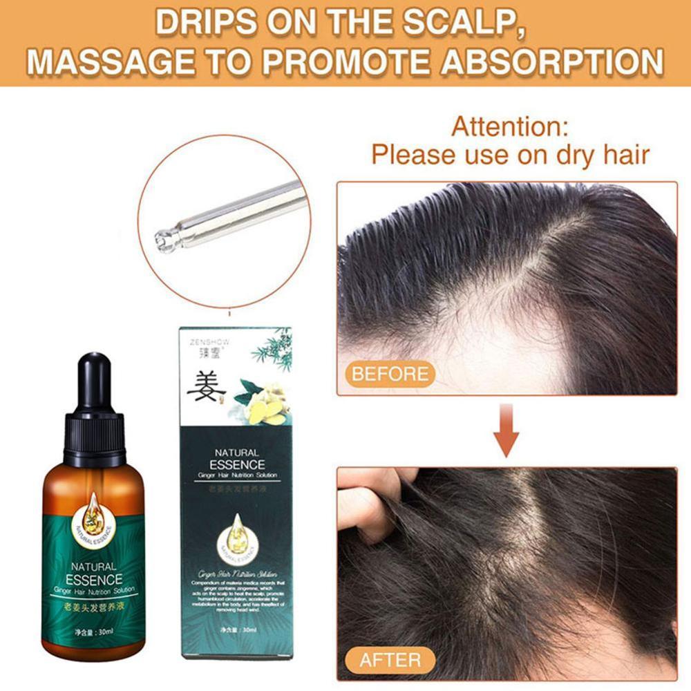 1pc 7X Rapid Growth Hair Treatment Anti Hair Loss Fast Growth Ginger Hair Oil Serum Essential 30ml J4F0