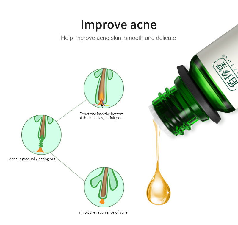 10ml Treatment Face Serum Tea Tree Essential Oil Remove Dark Spots Ance Burn Scar Smooth Skin Care Facial Essence Cream TSLM2