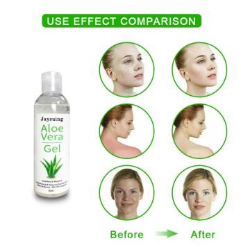 Day Creams Natural Aloe Vera Gel Face Moisturizer Anti Wrinkle Cream Acne Scar Skin Sunscreen Acne Treatment Skin Care TSLM1