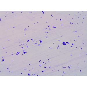 Water Soluble Probiotics Lactobacillus Plantarum