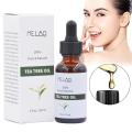 100% Natural Pure Tea Tree Essential Oil Acne Treatment Anti-Wrinkle Hydrating Oil-control Anti Pimples Face Skin Care 30ML