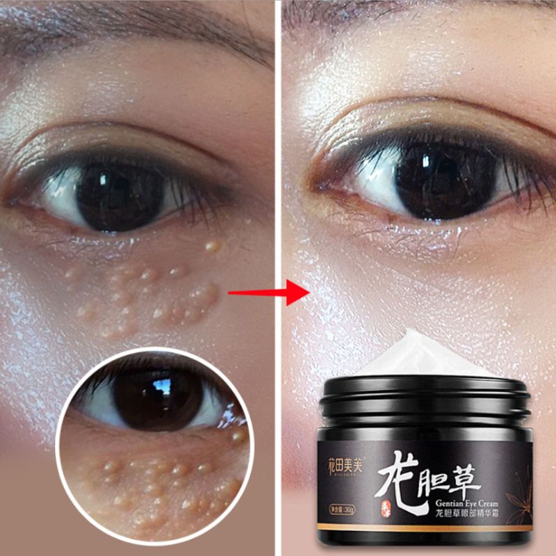 30g Natural Plant Gentian Grass Eye Cream Firming Bright Smooth Removes Dark Circles Fat Granules Anti-Wrinkle Essence Skin Care