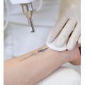 Choicy Academy Tattoo Removal Online Training