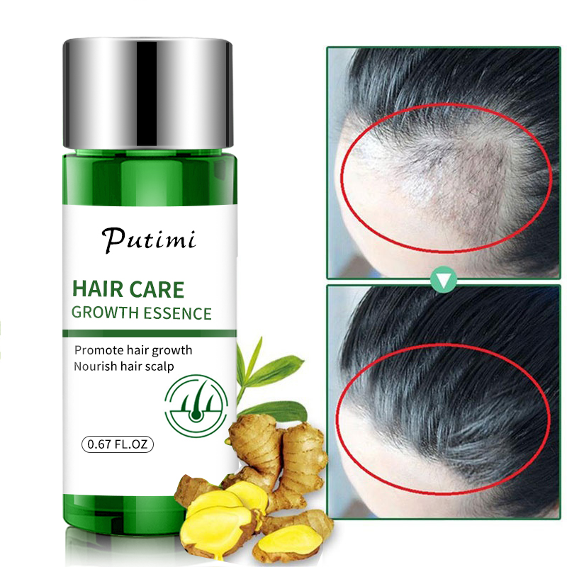 PUTIMI Fast Hair Growth Essence Hair Loss Treatment Products Help for Scalp Hair Growth Serum Repair Hairs Care for Women Men