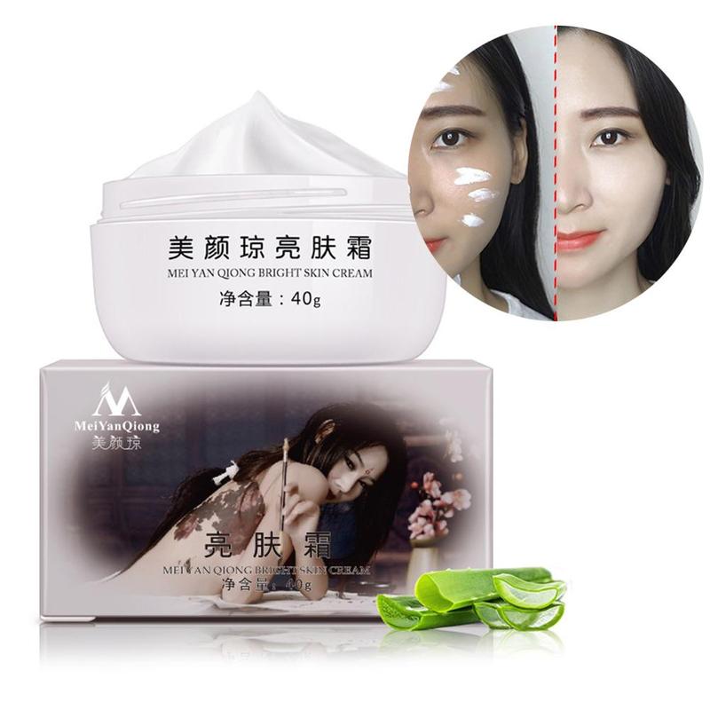 Powerful Brightening Skin Freckle Cream Remove Melasma Acne Spots Pigment Melanin Moisturizing Face Care Strong Effects 40g Hot