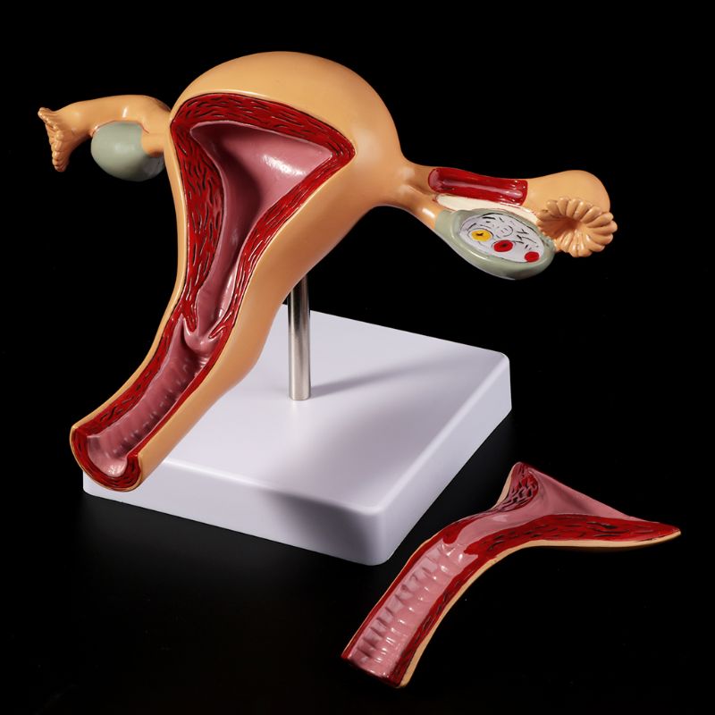 Human Pathological Uterus Ovary Model Anatomical Anatomy Disease Pathology Medical Lesion For Teaching