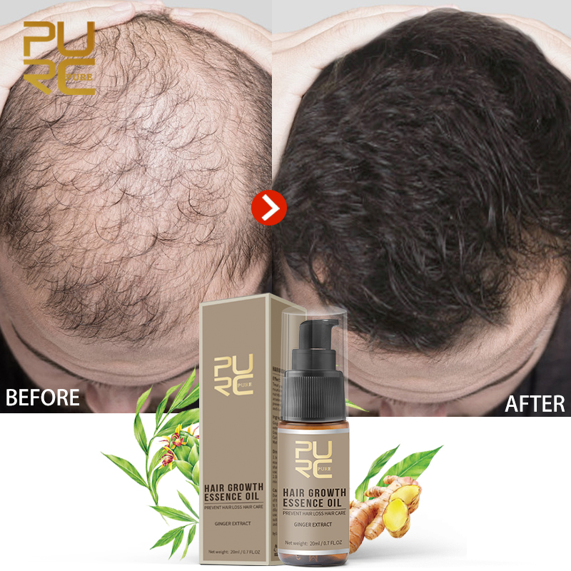PURC Hair shampoo and conditioner for hair growth prevent hair loss and 2pcs Growth Essence Oil and 1pcs Hair Growth Spray