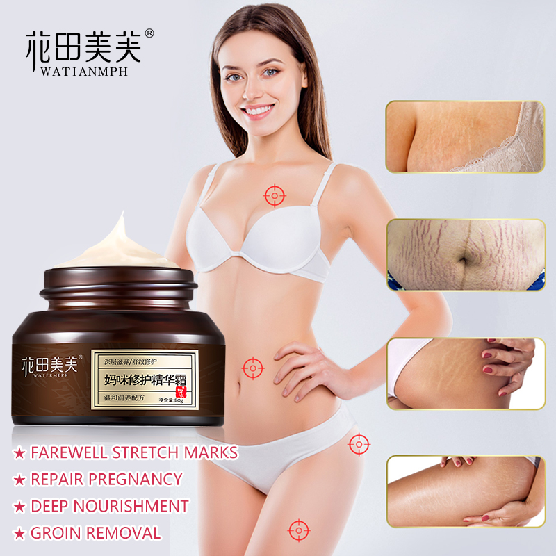Watianmph 50g cream for scar removal stretch mark removal maternity anti-wrinkle pregnancy repair female scar removal for Mom