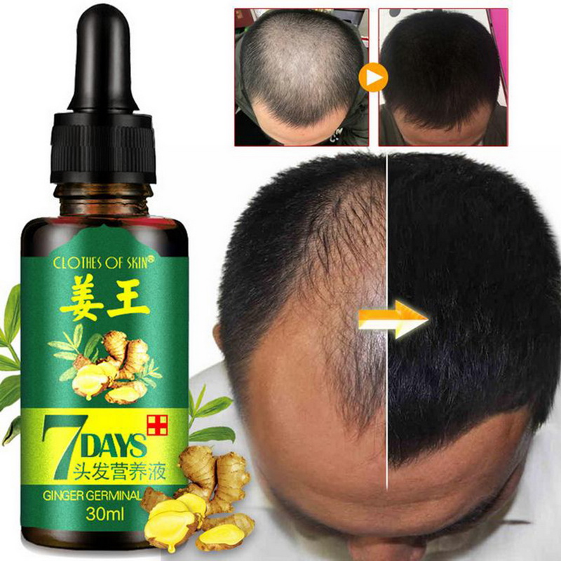 Professional Hair Growth Dense Hair Fast Hair Growth Grow Alopecia Essential Liquid Oil Treatment For Gentleman Hair Care 30ml
