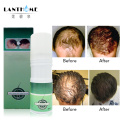 3pcs Original Lanthome growth hair spray Extra Strength Alopecia Hairs Growth Treatment Hairs Regrowth Spray Hair Loss Products