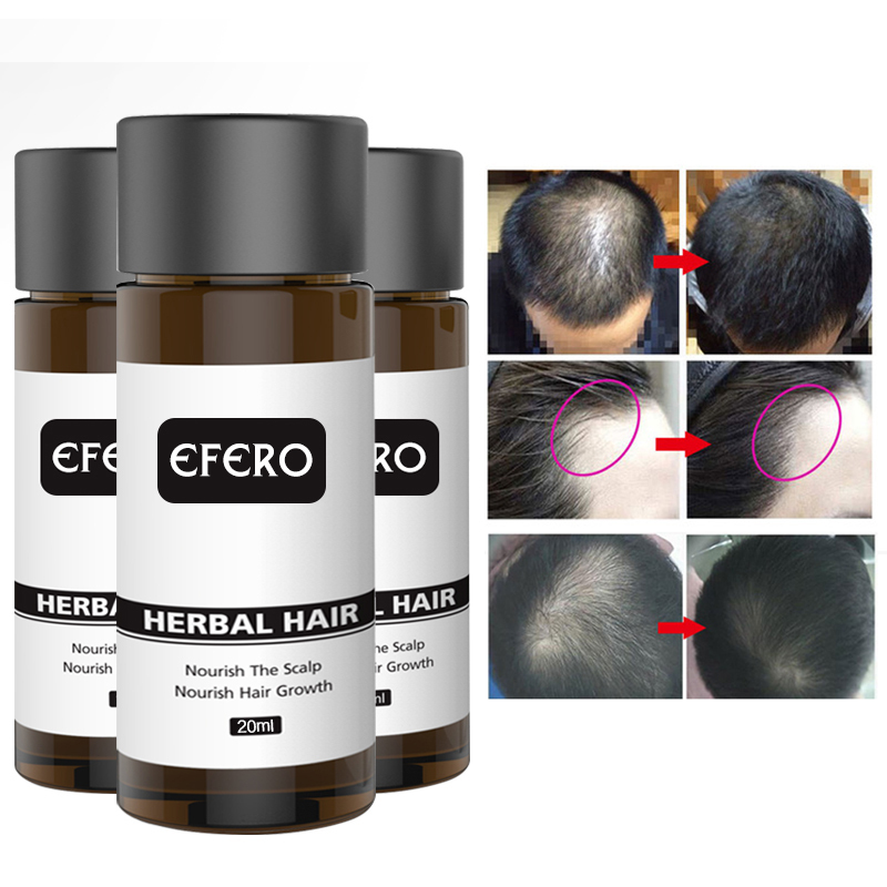 Efero Hair Care Hair Growth Essential Oils Hair Loss Dense Hair Fast Hair Growth Oil Grow Restoration Growing Serum TSLM2