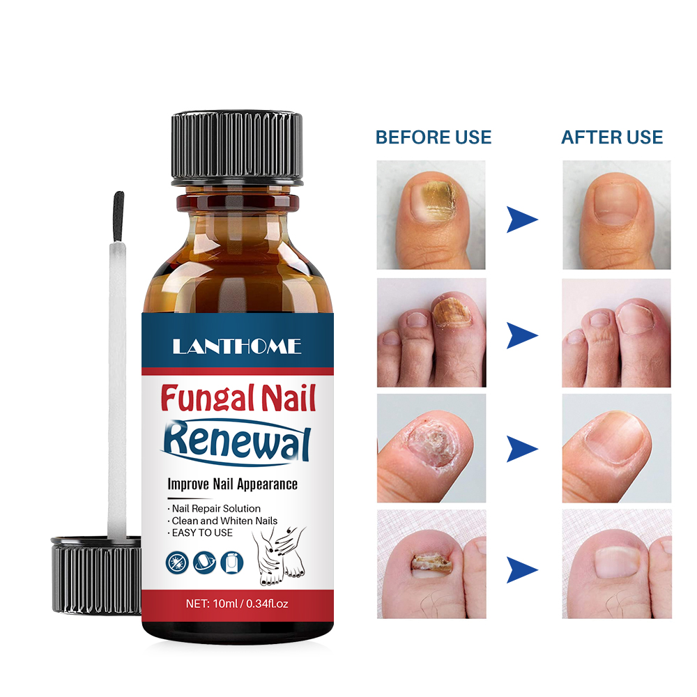 natural nail strengthener growth cuticle oil Nail Liquid Repair Treatment Nail Toe Fungus Removal Moisturizing Nail Foot Care