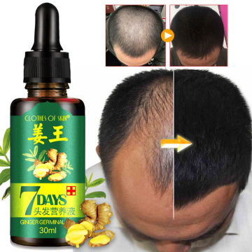 New 2020 30ML 7 Day Ginger Germinal Serum Essence Oil Natural Hair Loss Treatement Effective Fast Growth Hair Care