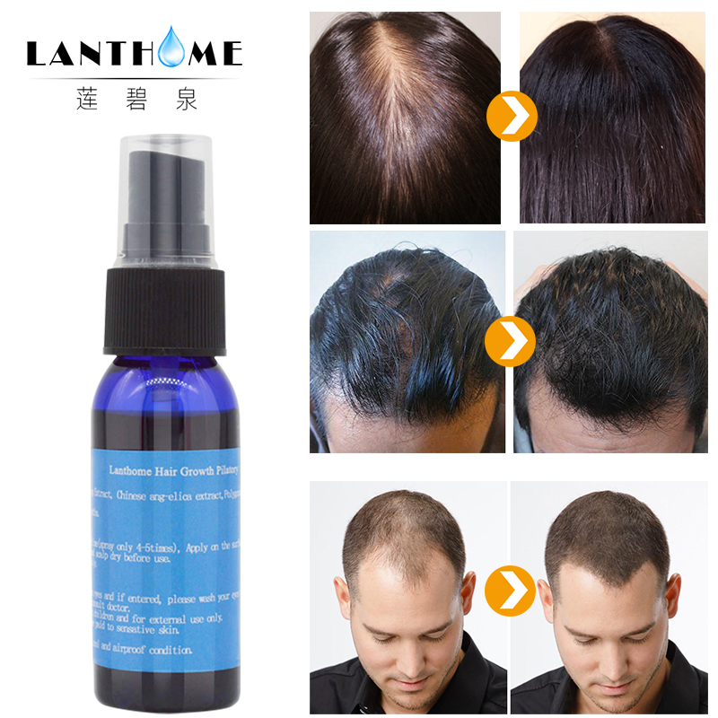 2pcs Herbal Fast Hair Growth Serum Oil Alopecia Anti Baldness Essence Hair Loss Spray Hair Regrowth Treatment Products Men Women