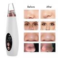 6 in 1 Blackhead Remover Cleaner Vacuum Tool Blackhead Acne Pimple Removal Electric Vacuum Suction Facial Skin Care Extractor