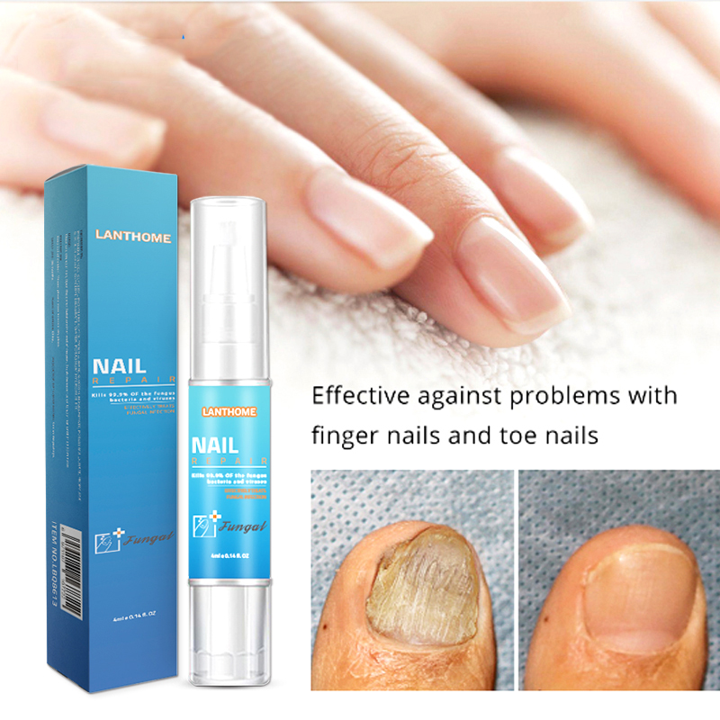 Fungal Nail Treatment Pen Fungal Nail Repair Remover Cuticle Oil Pen The Herb Bright Cream Disinfection Toe Nail Fungus Remover