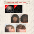 30ml Hair Natural Essence Faster Growing Spray Hair Care Help For Hair Repair Organic Ginger Hair Growth Spray Hair Care TSLM2