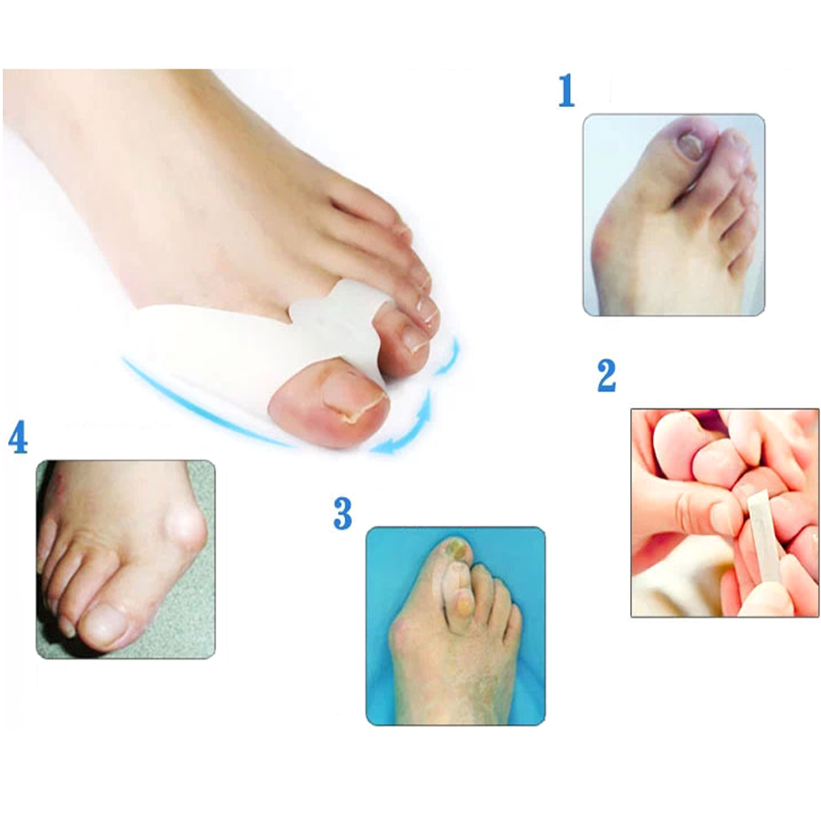 2Pcs Thumb Valgus Protector Silicone Gel foot fingers Two Hole Toe Separator Bunion Adjuster Hallux Valgus Feet Massager C142