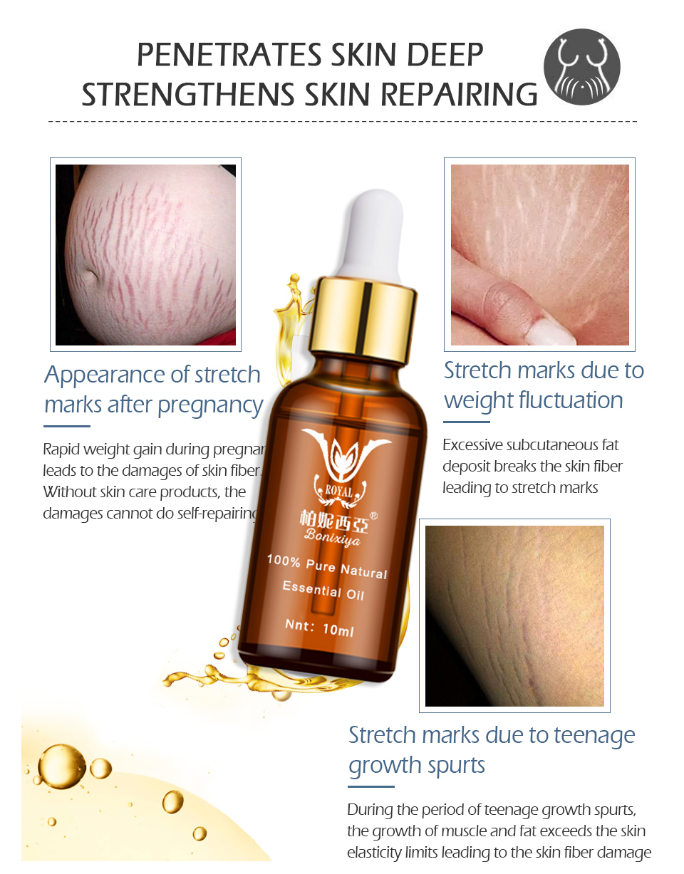 Stretch Marks Remover Essential Oil Eliminate Pregnancy Scars Maternity Repair Anti Winkle Skin Firming Treatment