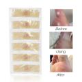 42pcs Foot Warts Thorn Patch Painless Foot Care Home Portable Feet Callus Removal Tool Soften Skin Cutin Dropship