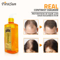 Professional Hair Ginger Shampoo 300ml, Hair Regrowth Dense Fast,Thicker, Shampoo Anti Hair Loss Product Repair Nourish Supple