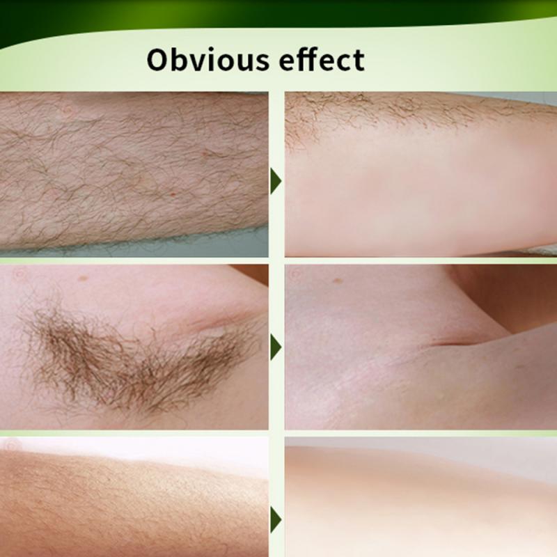 70g Painless Depilatory Hair Removal Cream Whole Body Leg Armpit Unisex Moisturizing Non-Irritating Hair Growth Inhibitor Cream