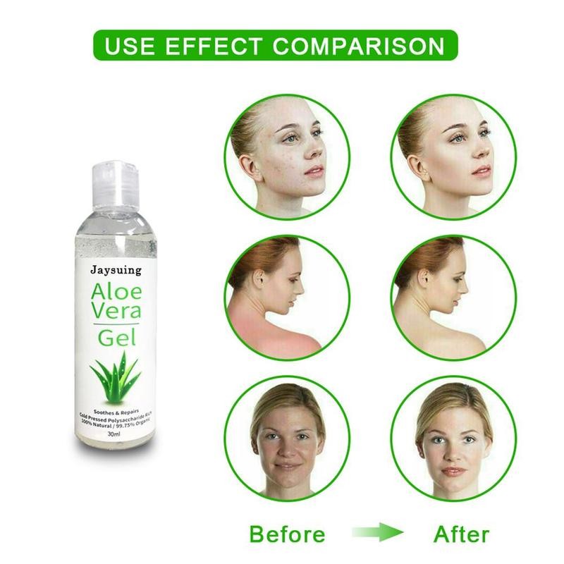 30/50/100ml Natural Aloe Vera Gel Soothing Moisturizer Acne Sunscreen Treatment Treatment Care Skin Skin Lotion Cream Gel H0Z4