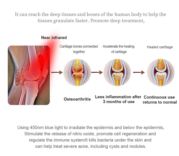 Red Light Therapy Bed Benefits