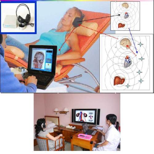 innovative bio-resonator 3d nls quantum body health analyzer for Sale, innovative bio-resonator 3d nls quantum body health analyzer wholesale From China