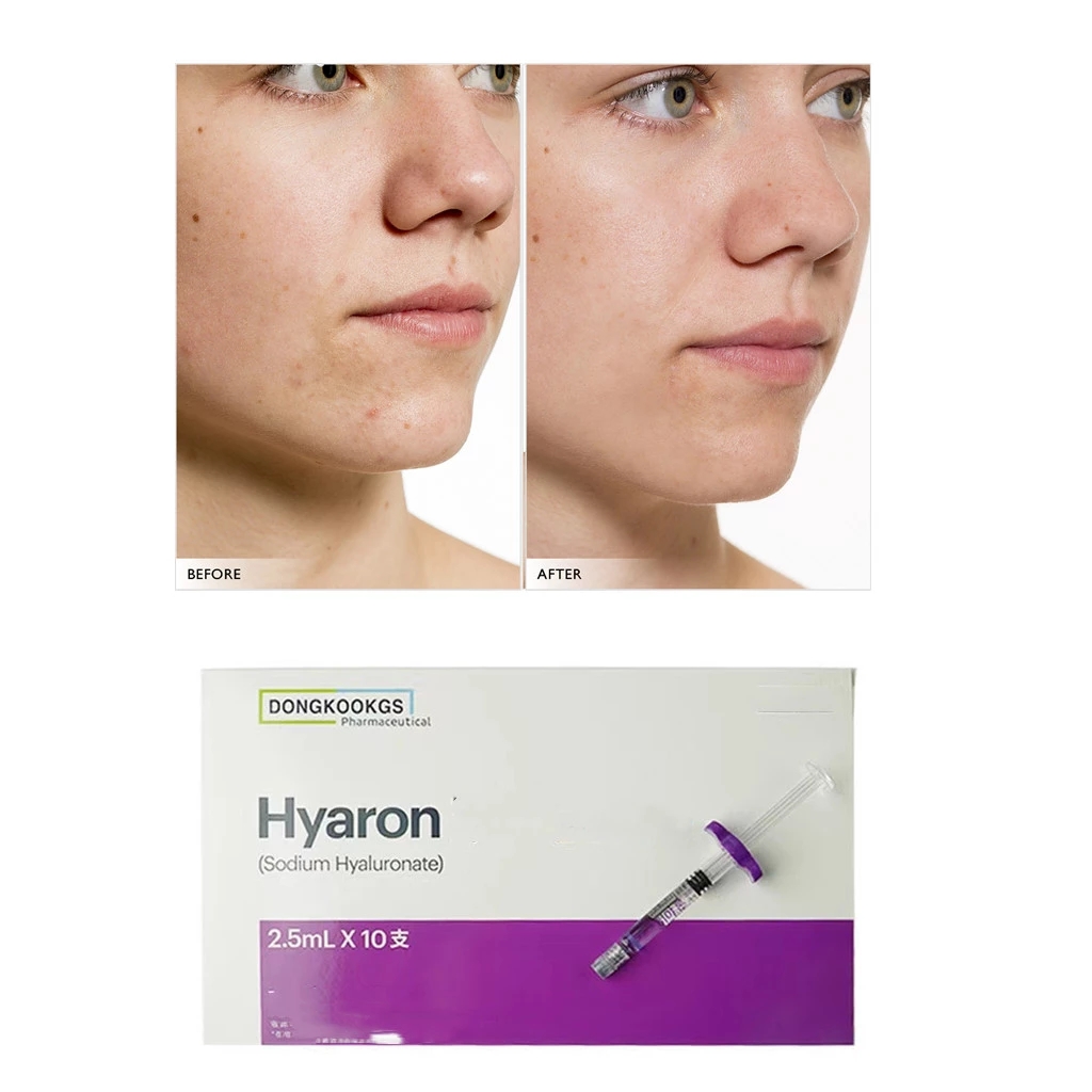 2-5ml-hyaron-face-wrinkles-removal-skin-watering-moisturize-nutrition-skinbooster-BB-Bream.jpg_Q90.jpg_.webp
