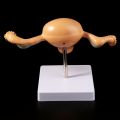 Medical props model Human Pathological Uterus Ovary Model Anatomical Anatomy Disease Pathology Medical Lesion For Teaching
