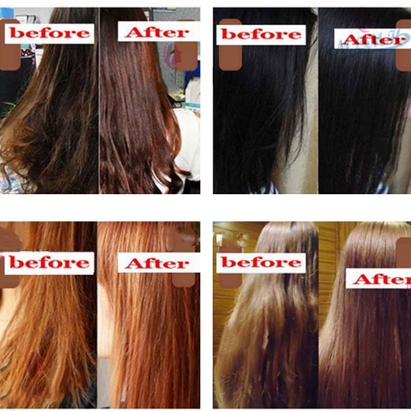 Fast Hair Growth Thickener Essence Anti-Hair Loss Treatment Hair Regrowth Baldness Beard Oil 30ml EY669