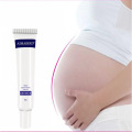 Natural Scar Repair Cream Postpartum Stretch Marks Acne Burn Pregnancy Scar Removal Smooth Body Skin Treatment&Care Products 20g