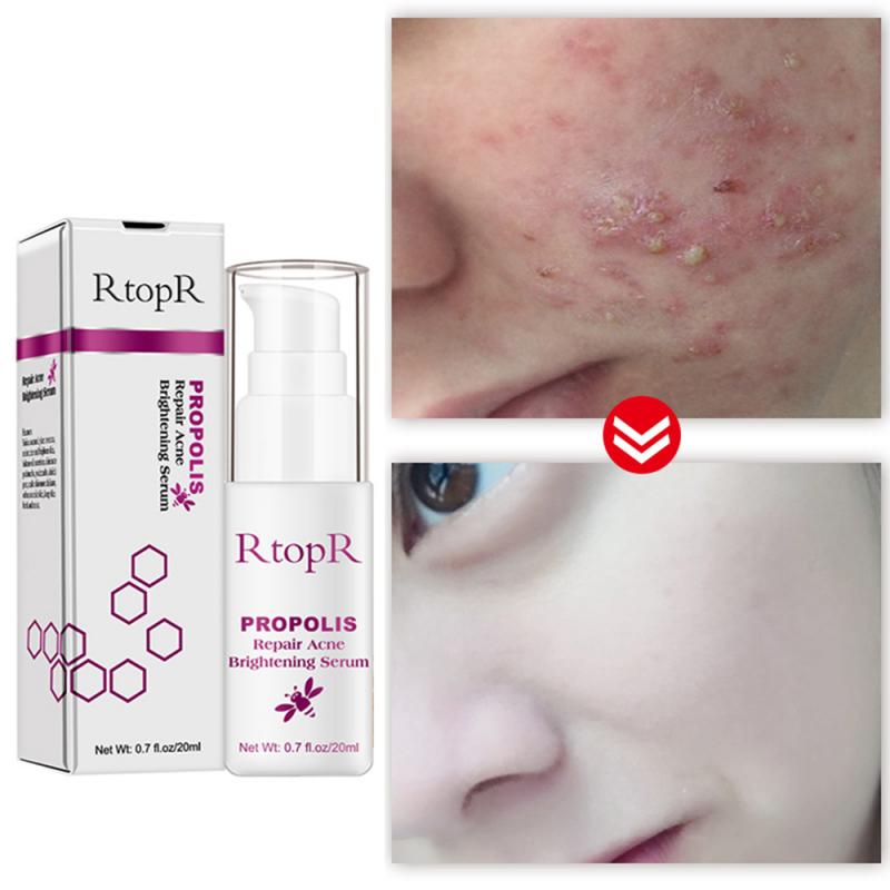 Propolis Hyaluronic Acid Collagen Face Serum Remover Acne Anti Wrinkle Repair Essence Shrink Pores Skin Care TSLM1