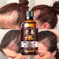 Hot sale Fast Hair Growth Dense Regrowth Ginger Serum Oil Anti Loss Treatment Essence Bin Wild Hair Growth Tools Hair Care 30ml