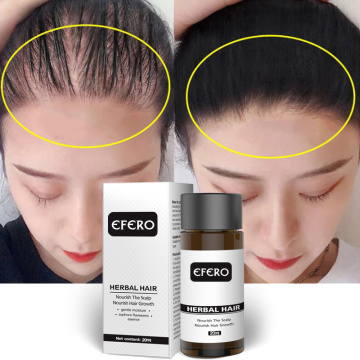 Powerful serum for hair growth prevents hair loss thicker essential oil to prevent hair growth Anti-Hair Loss Serum TSLM1