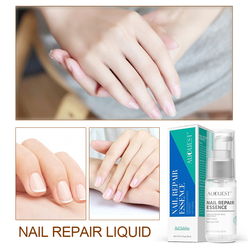 AUQuest Bactericidal Natural Essence Oil Nail Liquid Repair Treatment Toe Fungus Removal Moisturizing for Nail Foot Care TSLM1