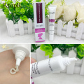 Acne Scar Stretch Marks Remover Cream Skin Repair Face Cream Acne Spots Acne Treatment Blackhead Whitening Cream Skin Care 3pcs